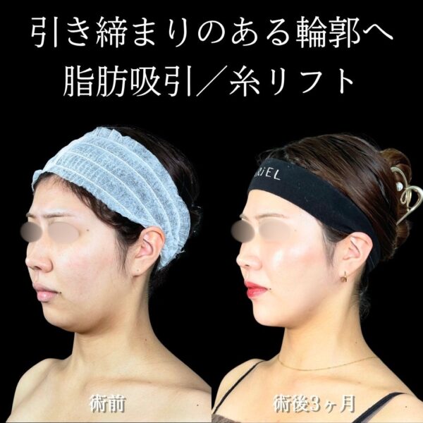 No.18330の症例写真 No.18330の症例写真