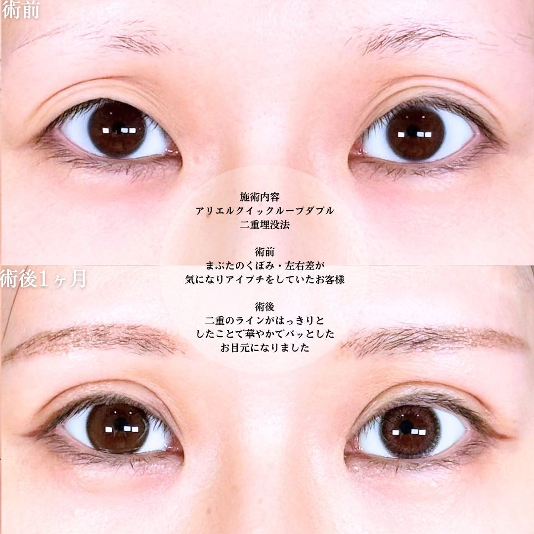 No.17978の症例写真1