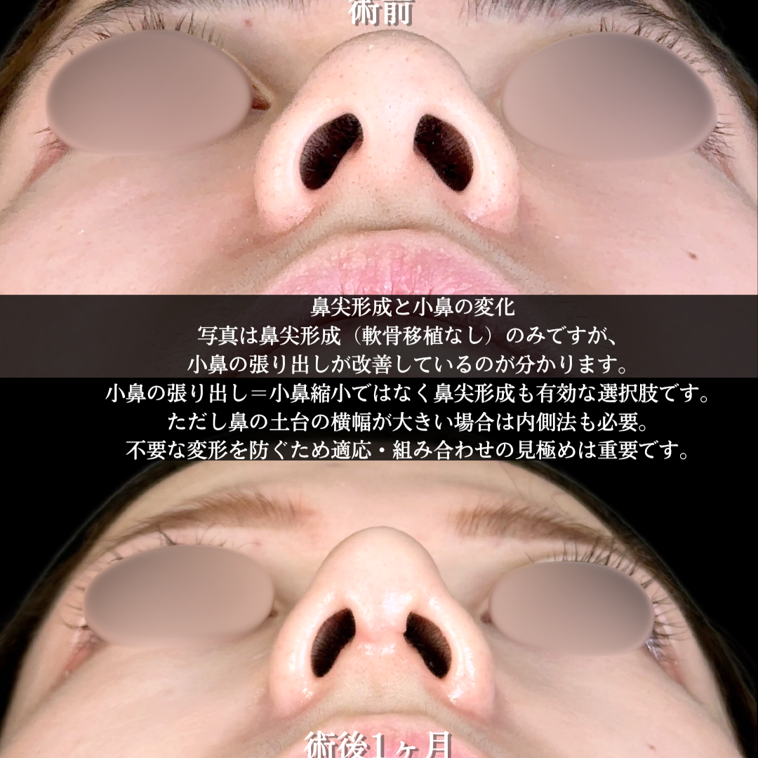 No.17942の症例写真1