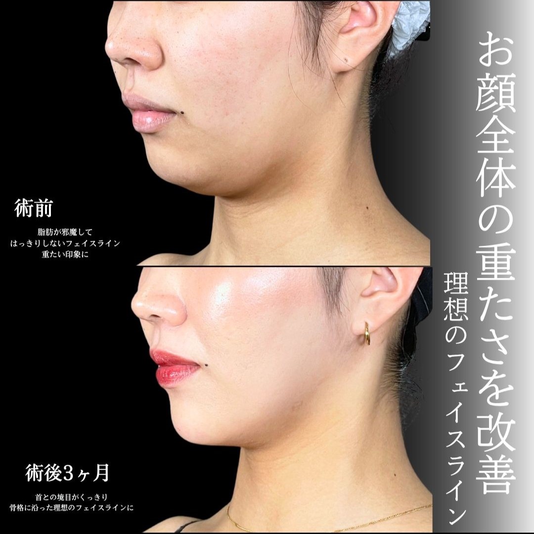 No.18330の症例写真1 No.18330の症例写真1