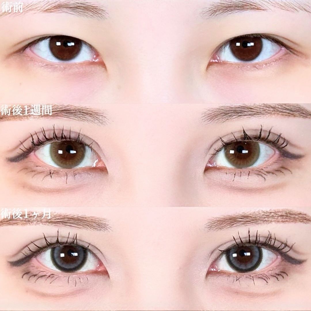 No.18157の症例写真 No.18157の症例写真