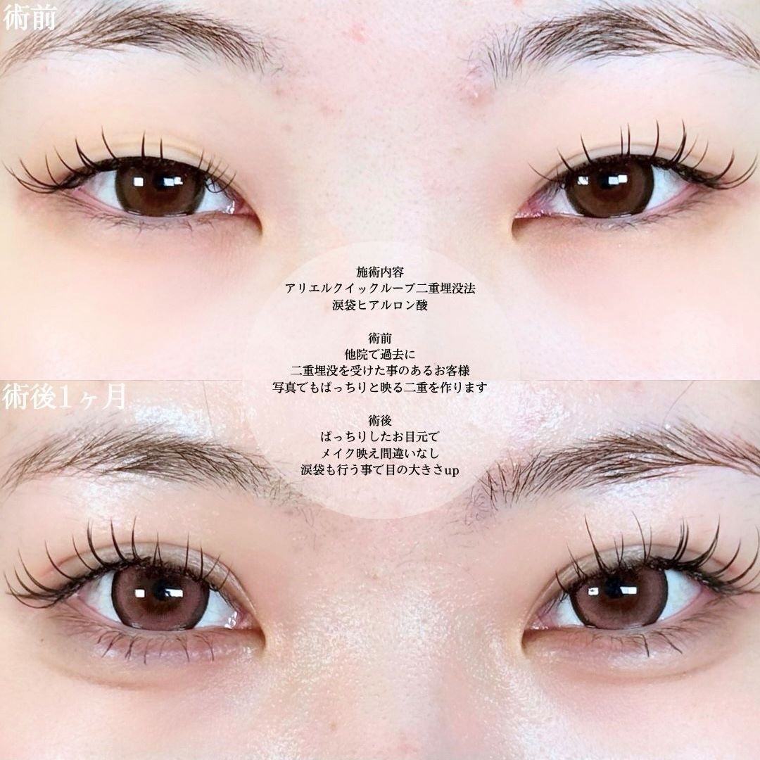 No.18323の症例写真1 No.18323の症例写真1