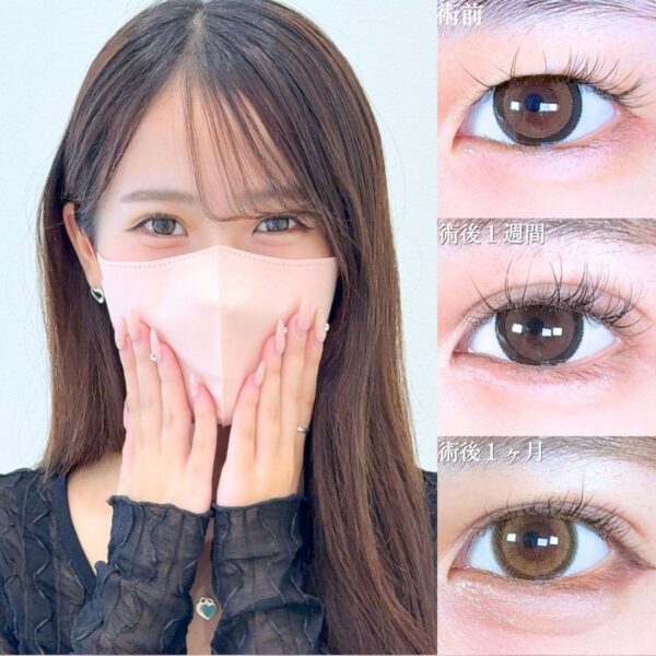No.18009の症例写真
