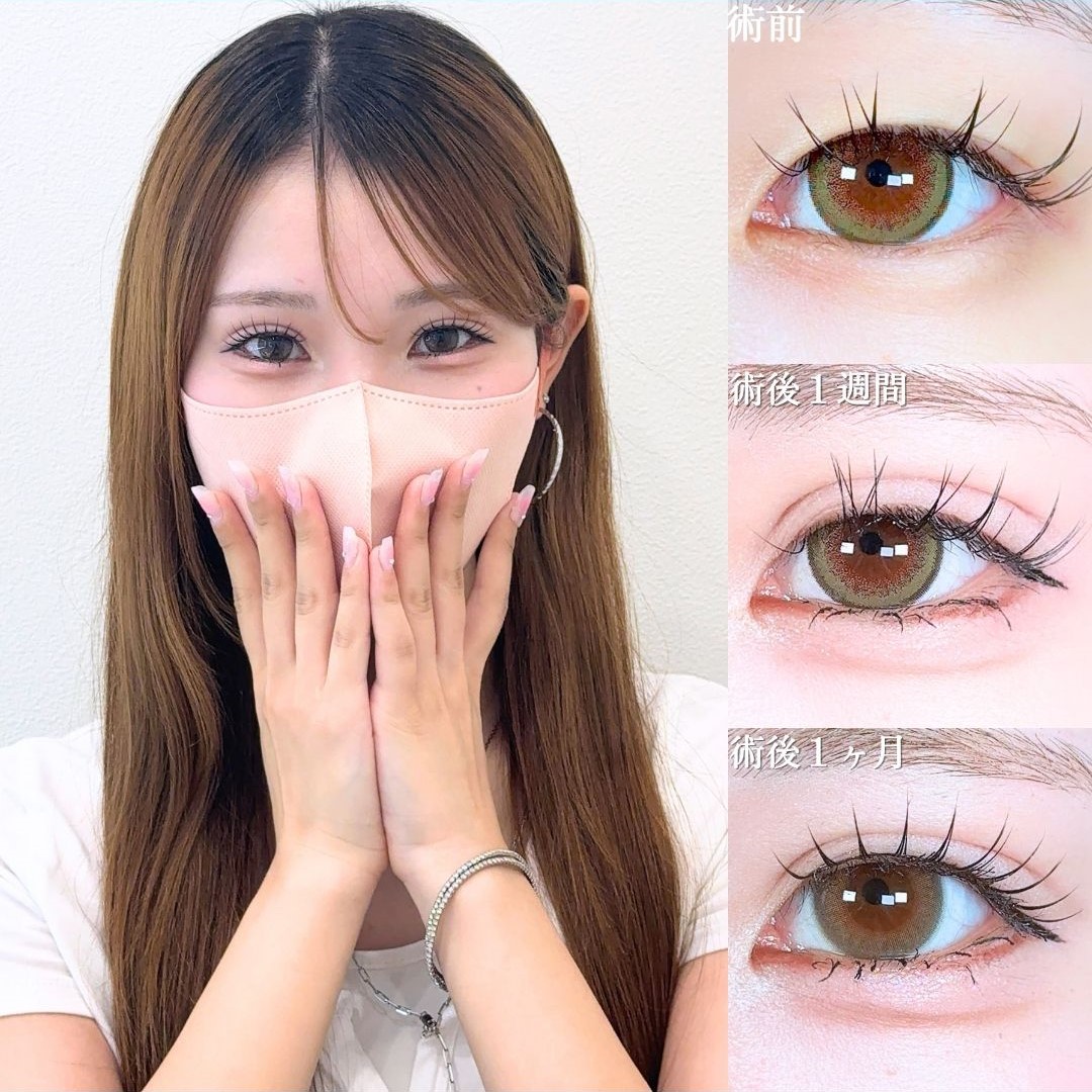 No.18455の症例写真