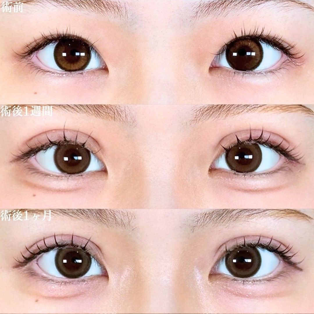 No.18462の症例写真