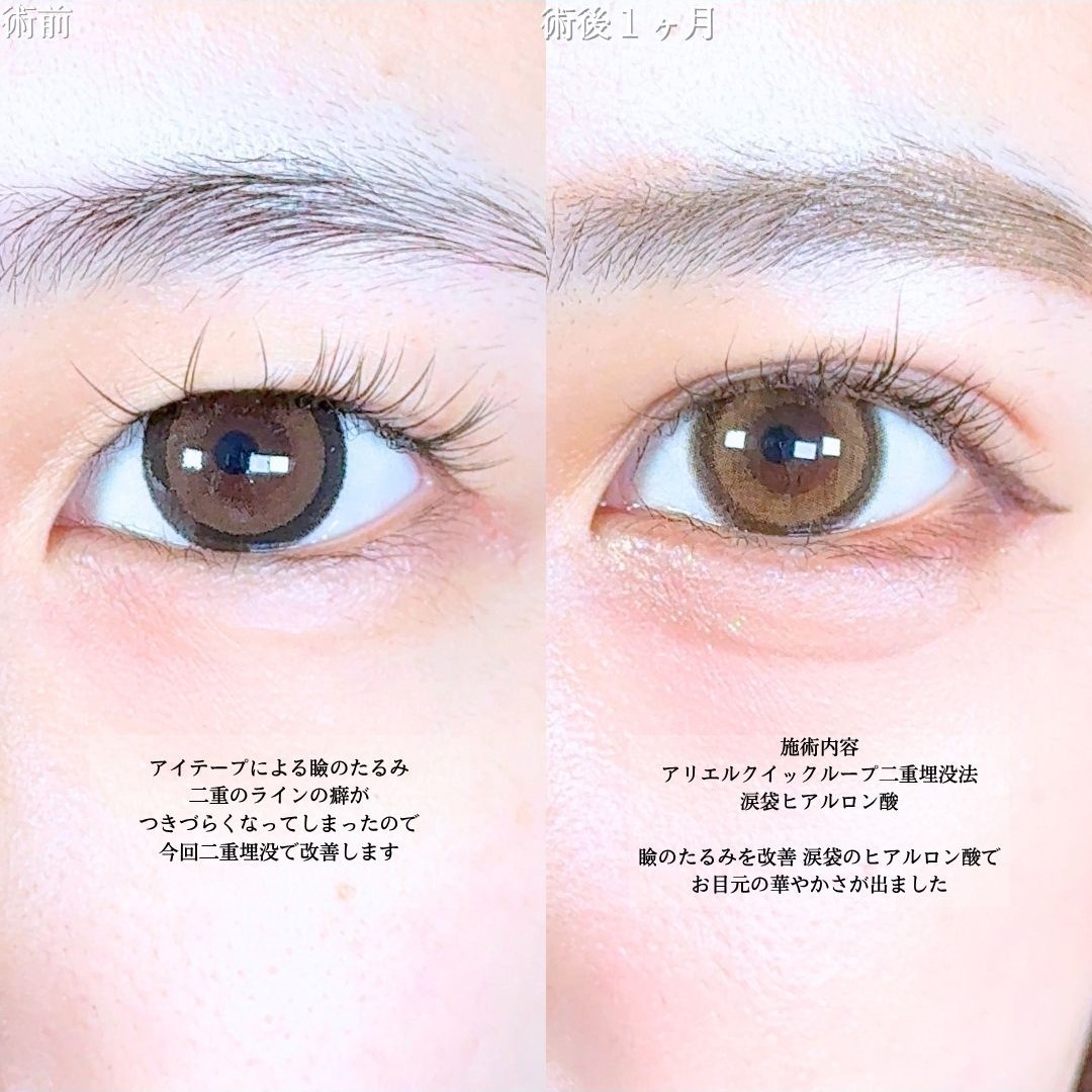 No.18009の症例写真1