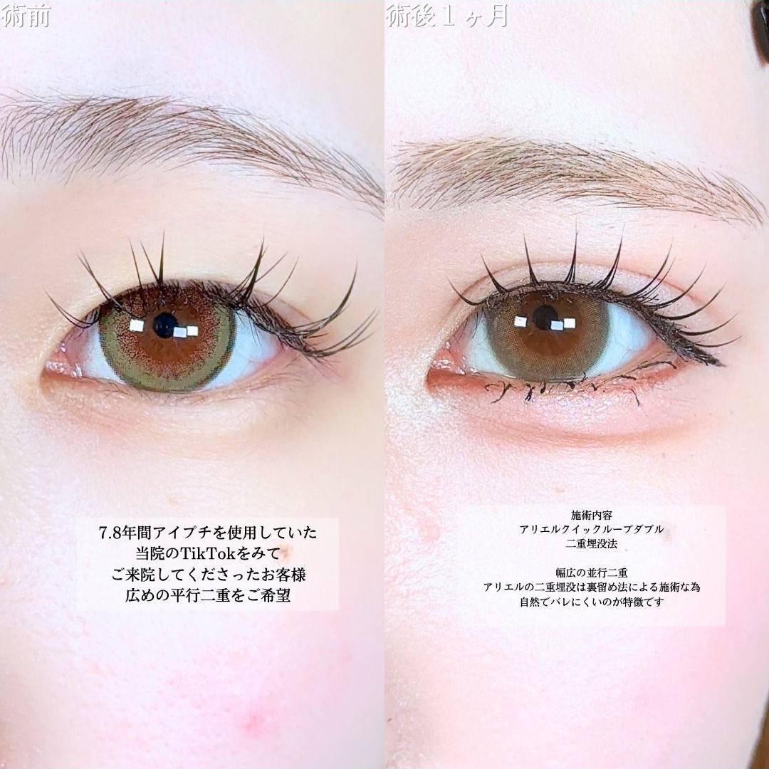 No.18455の症例写真1