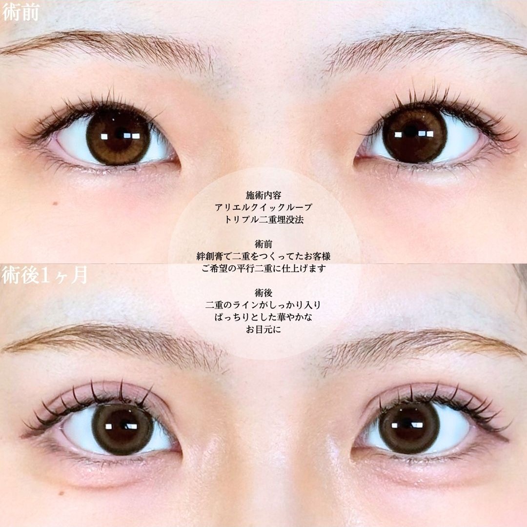 No.18462の症例写真1