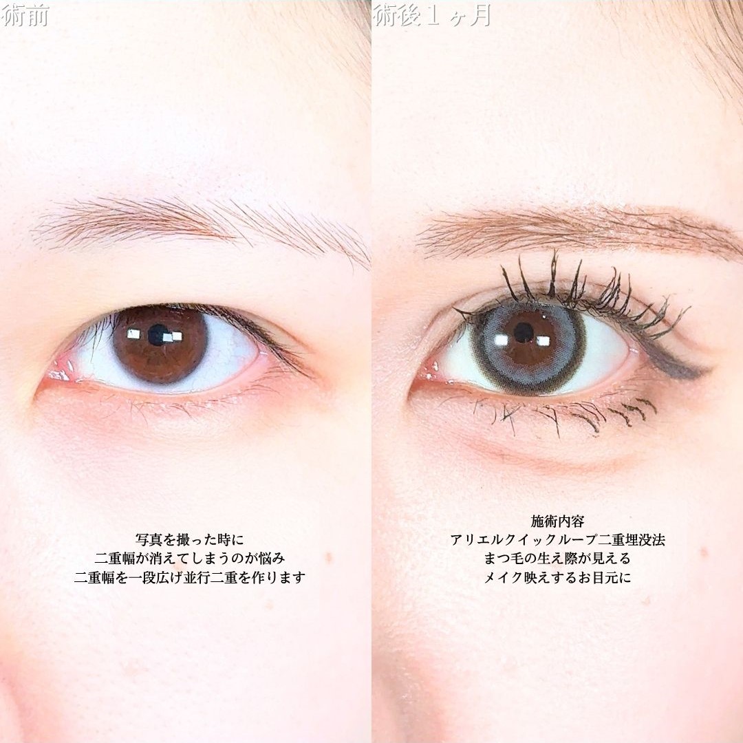 No.18151の症例写真1
