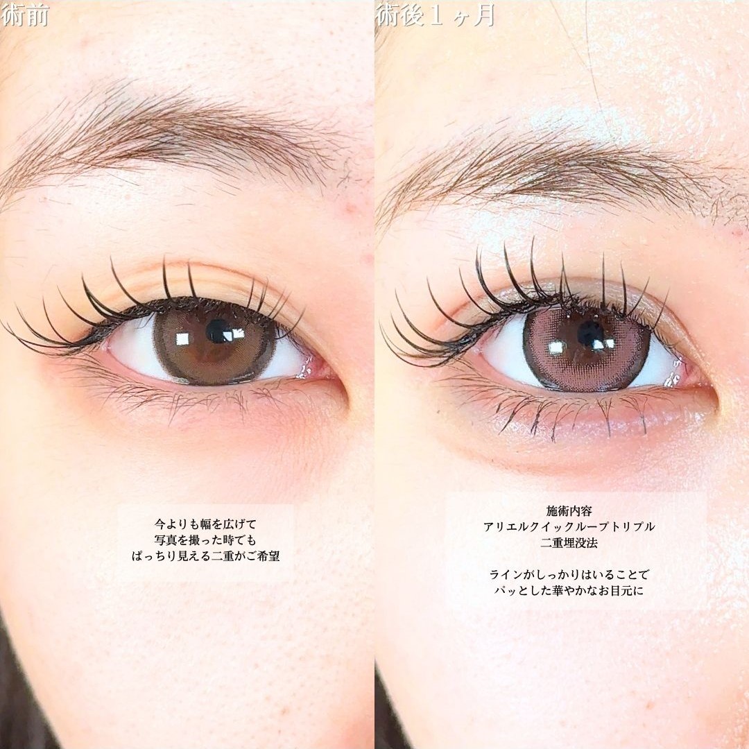 No.18268の症例写真1 No.18268の症例写真1