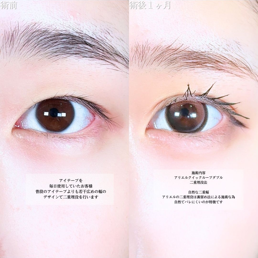 No.18423の症例写真1