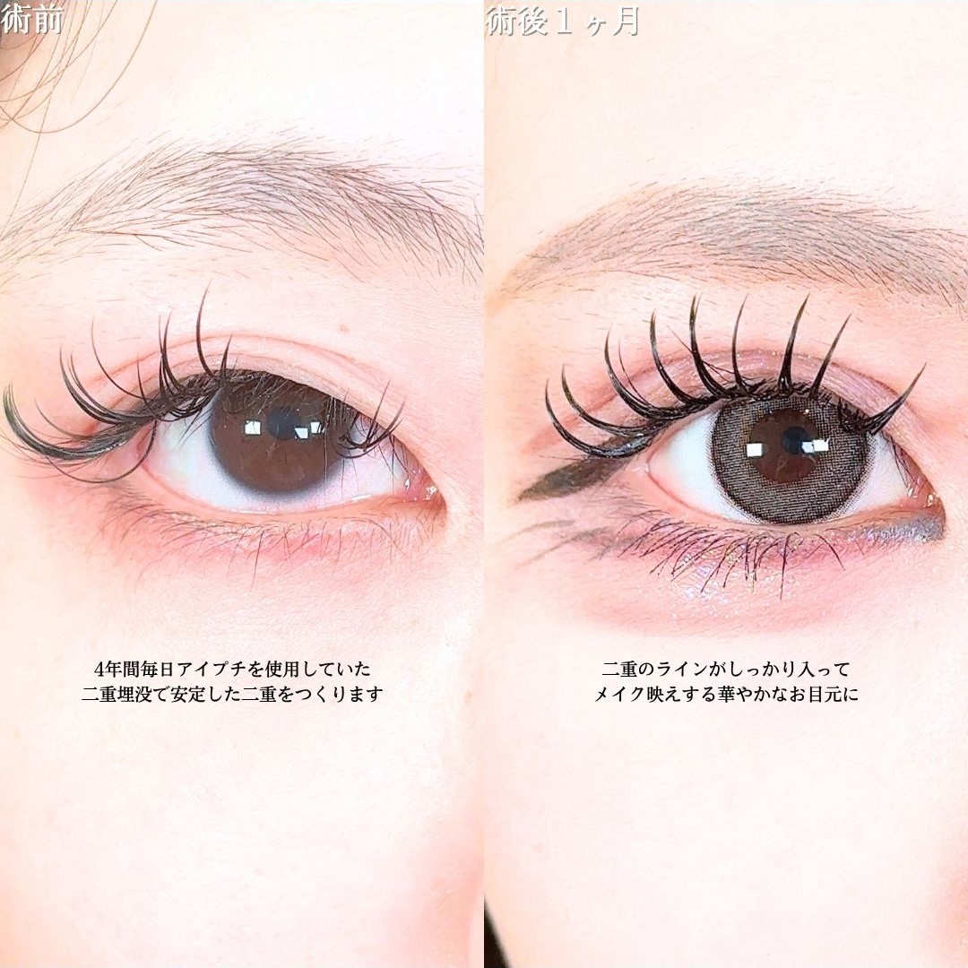 No.17845の症例写真1