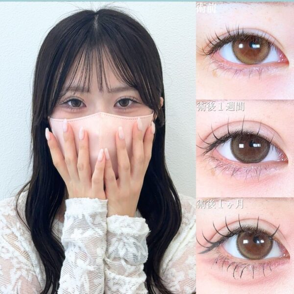 No.18063の症例写真