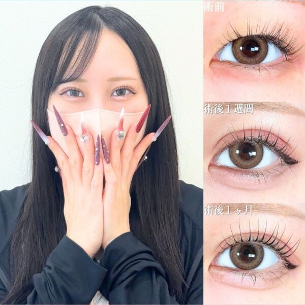 No.18104の症例写真