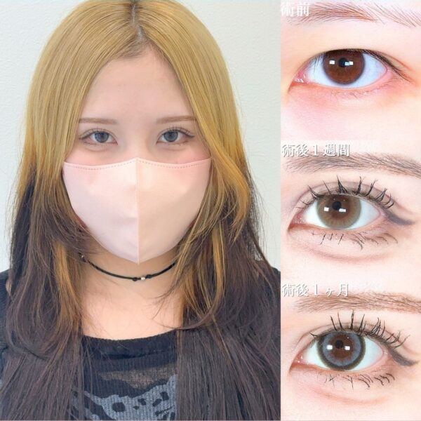 No.18151の症例写真