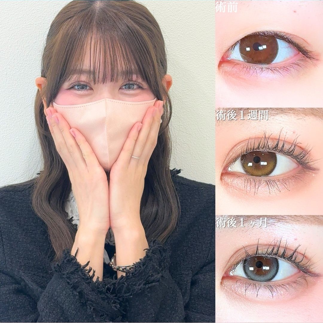 No.18188の症例写真 No.18188の症例写真