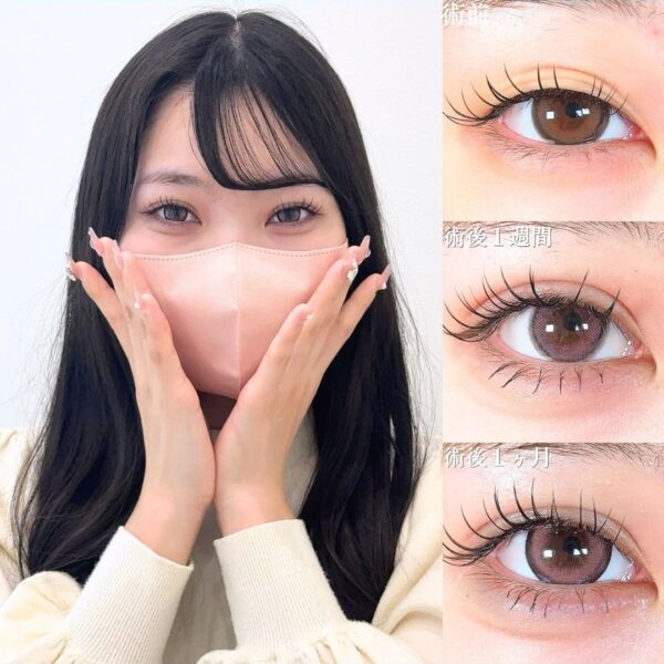 No.18268の症例写真 No.18268の症例写真