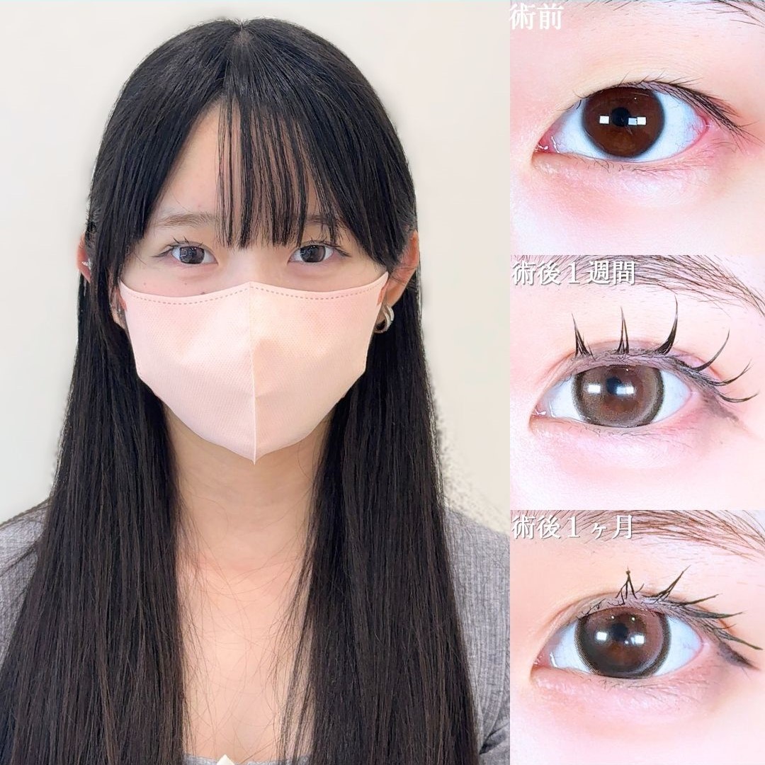 No.18423の症例写真