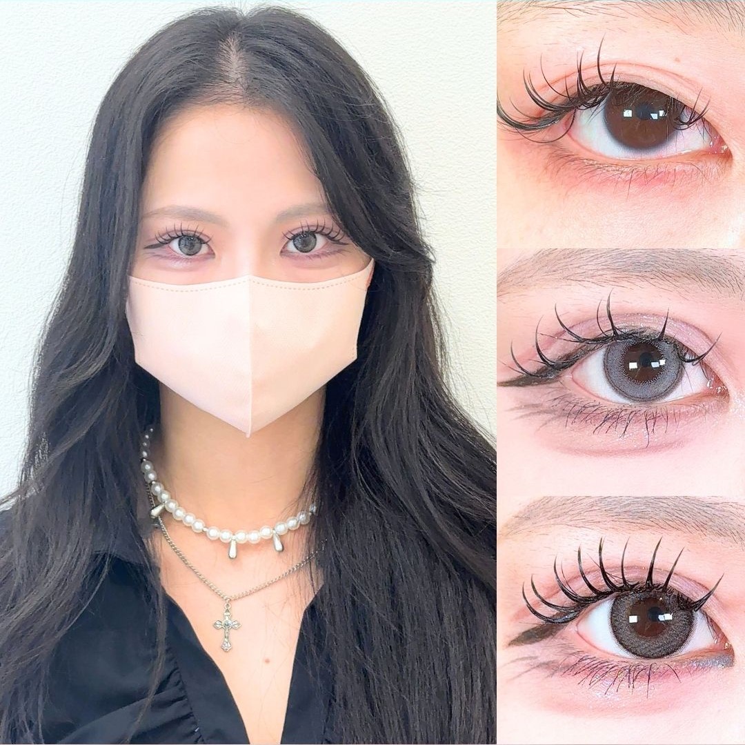 No.17845の症例写真 No.17845の症例写真