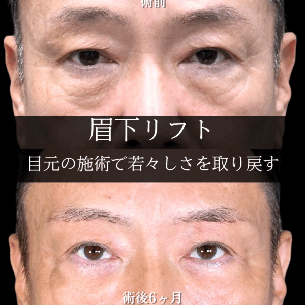 No.17924の症例写真