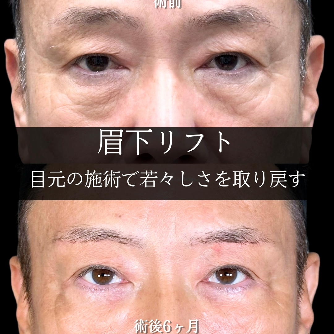 No.17924の症例写真