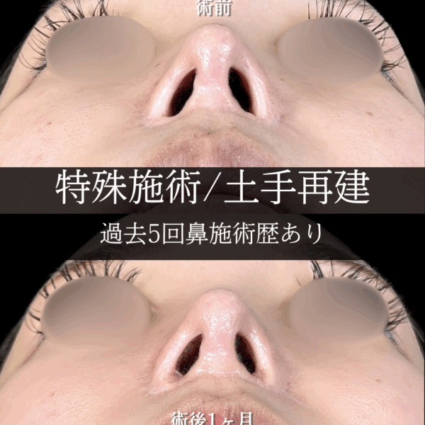 No.17950の症例写真