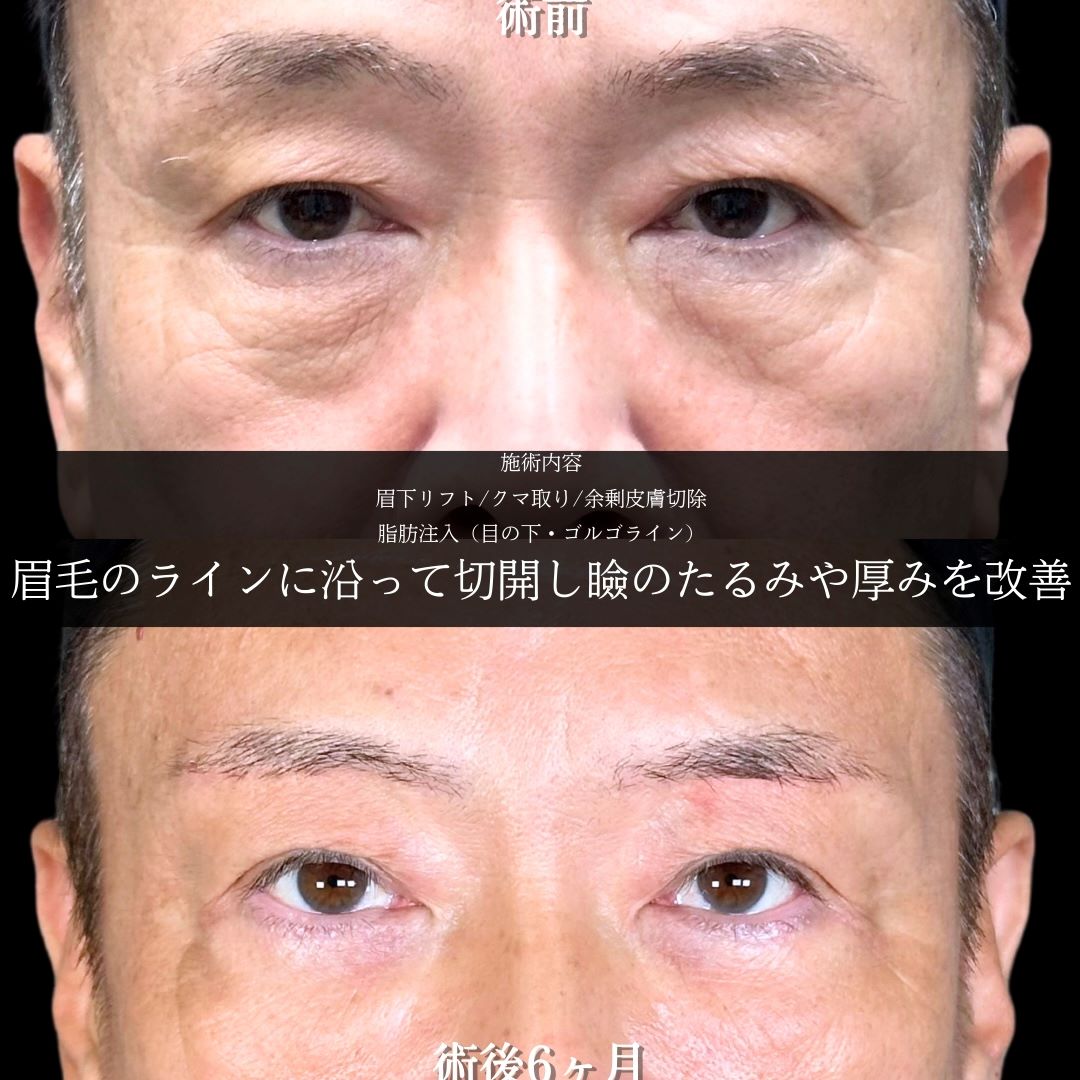 No.17924の症例写真1