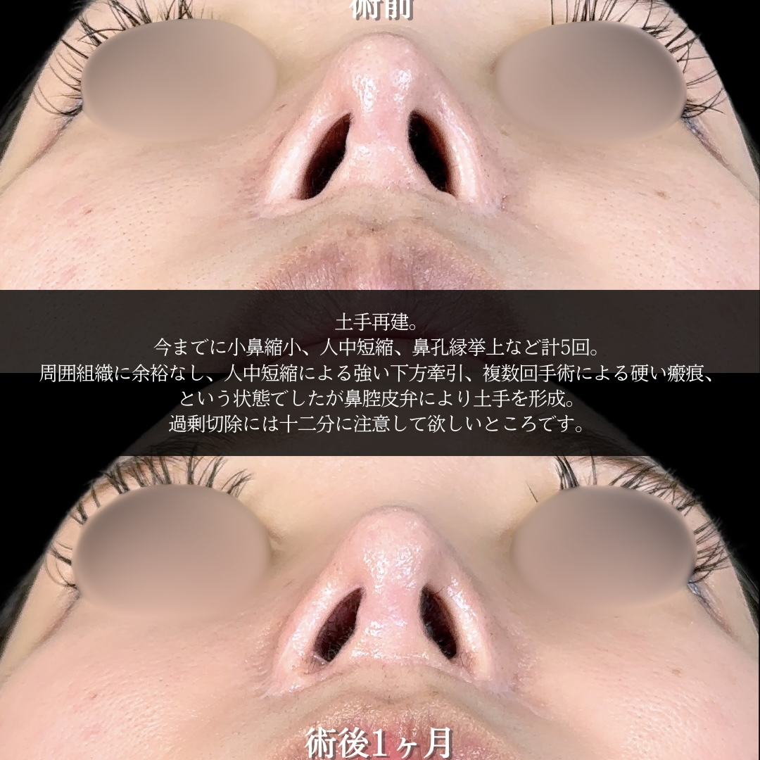 No.17950の症例写真1