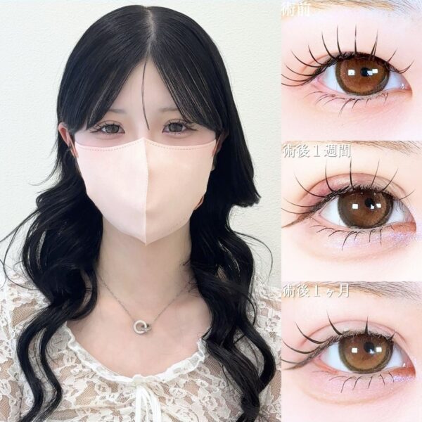 No.18313の症例写真 No.18313の症例写真