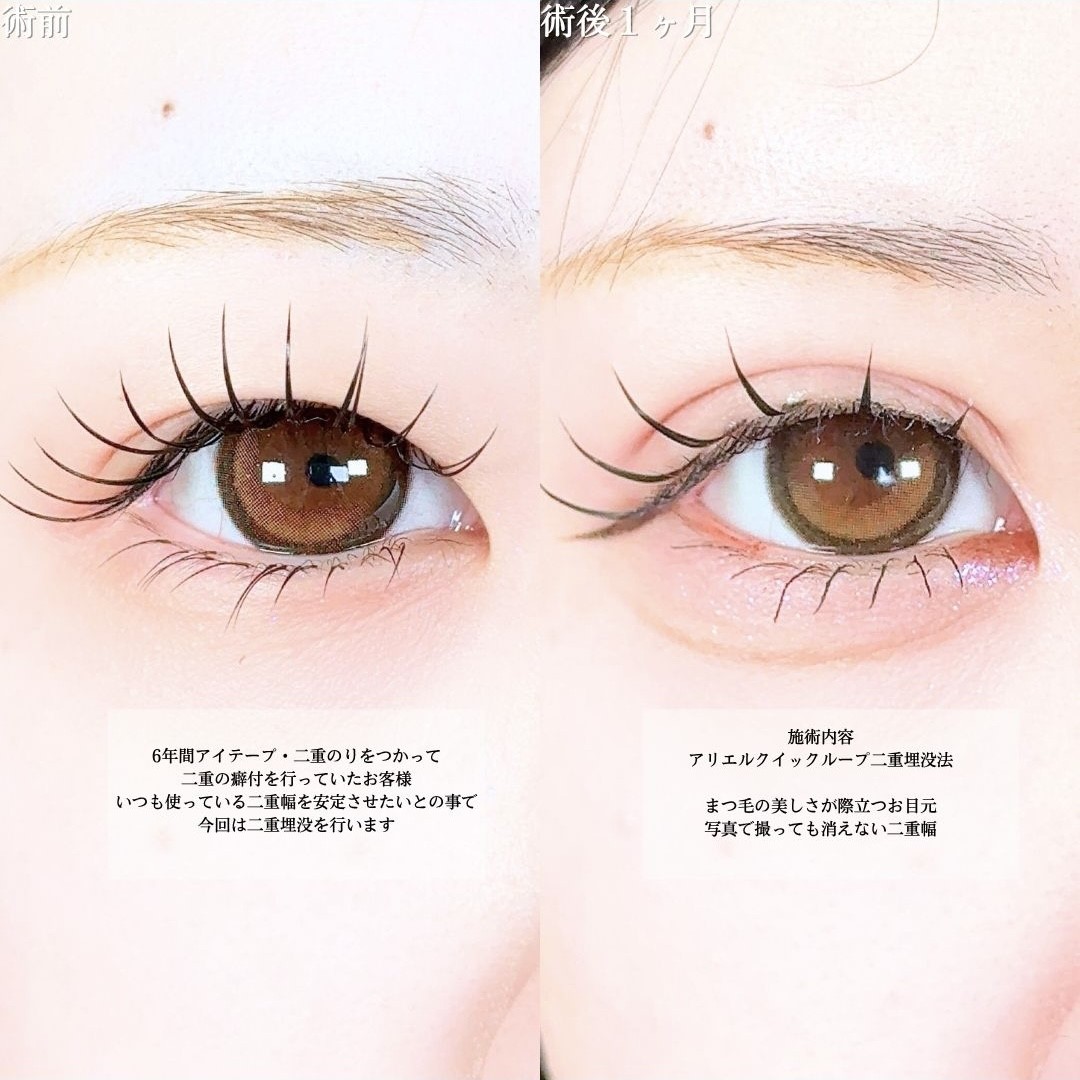 No.18313の症例写真1 No.18313の症例写真1
