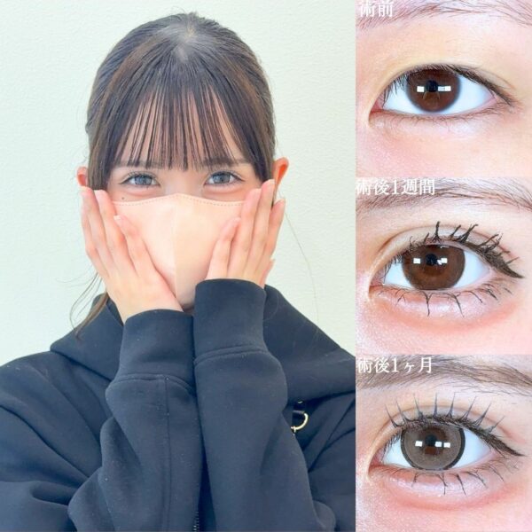 No.18523の症例写真