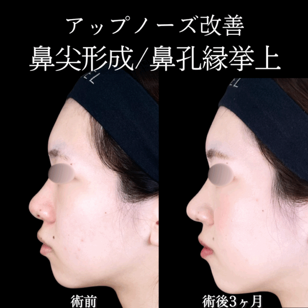 No.18535の症例写真