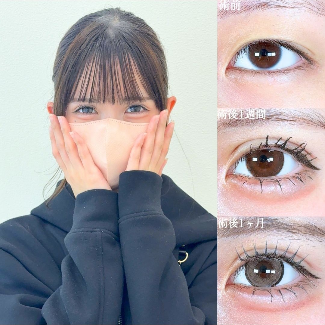 No.18523の症例写真