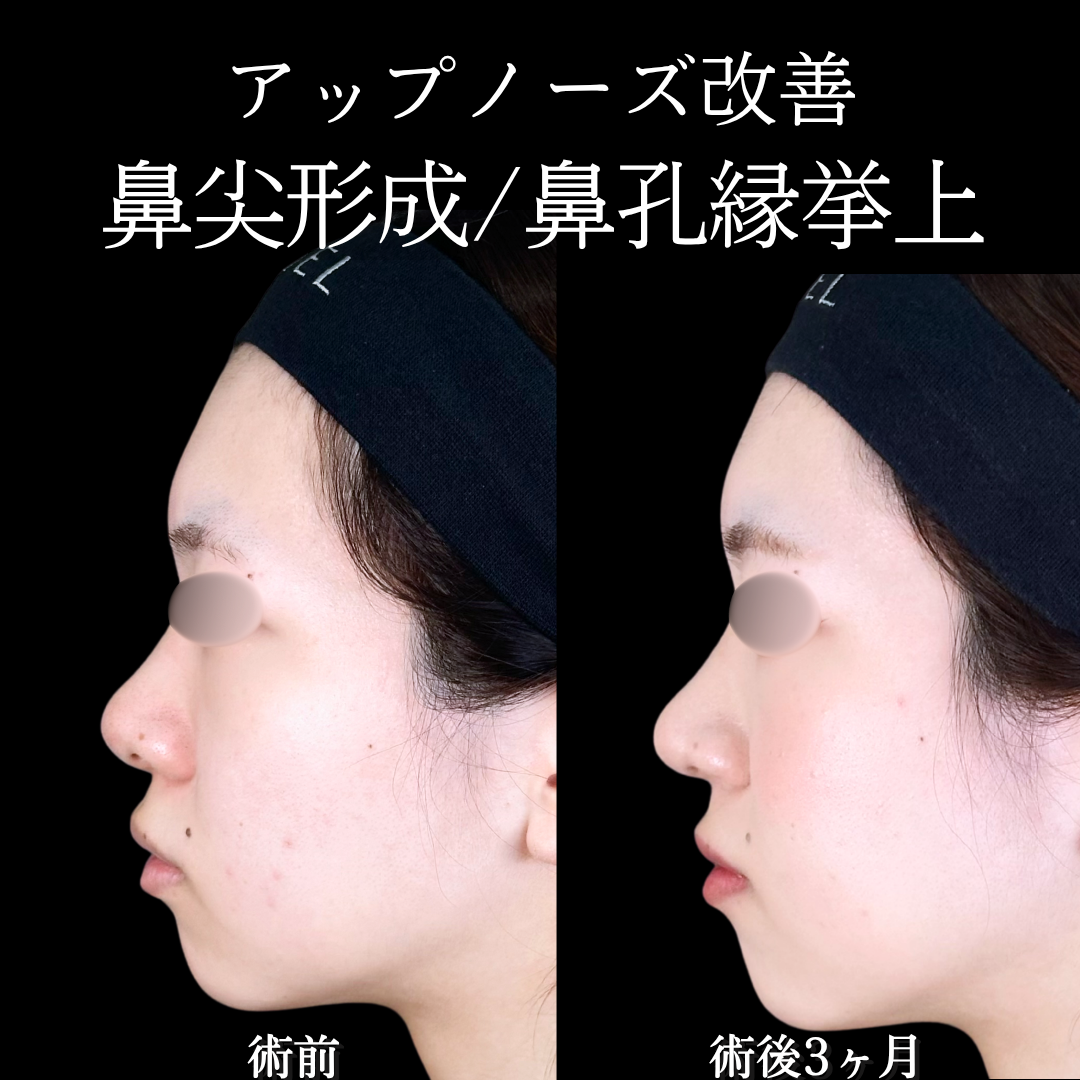 No.18535の症例写真