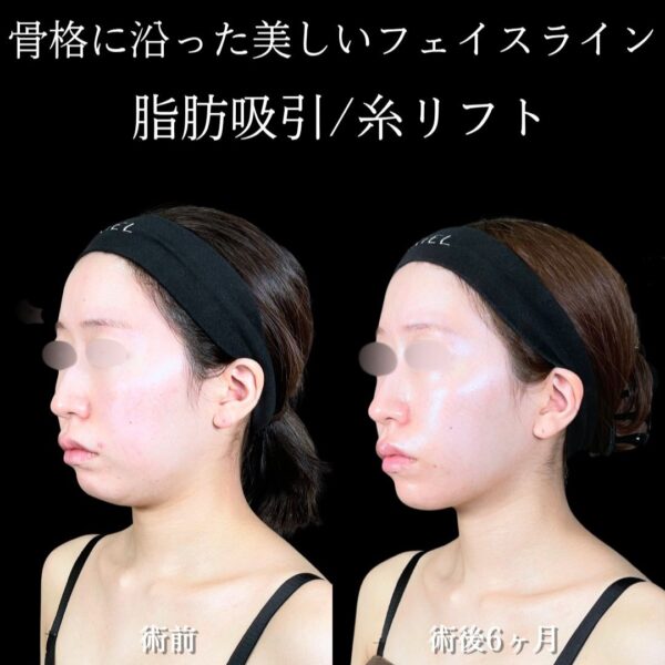 No.18572の症例写真 No.18572の症例写真