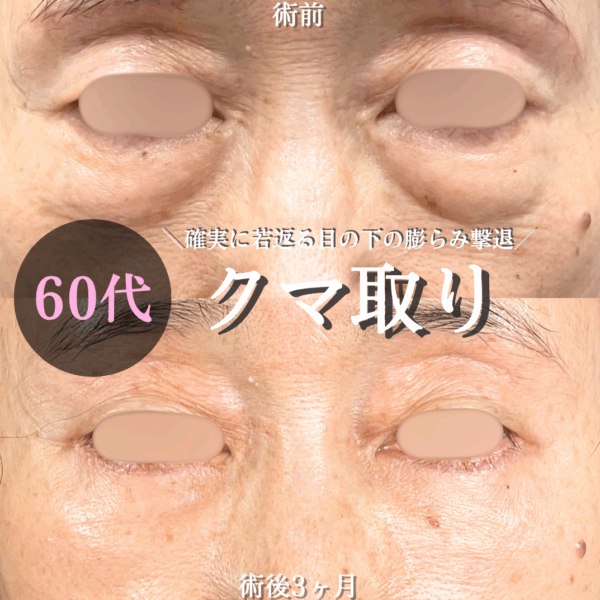 No.18542の症例写真