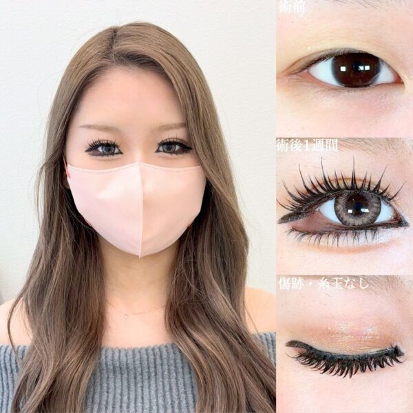 No.18595の症例写真 No.18595の症例写真