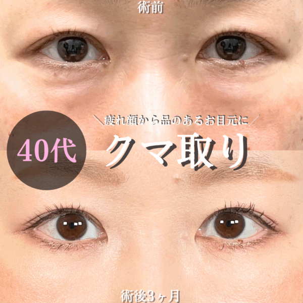 No.18638の症例写真 No.18638の症例写真