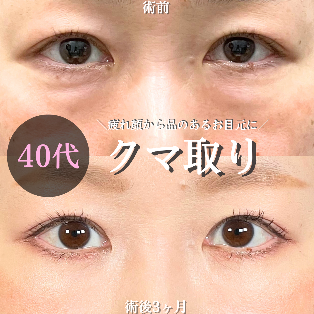 No.18638の症例写真