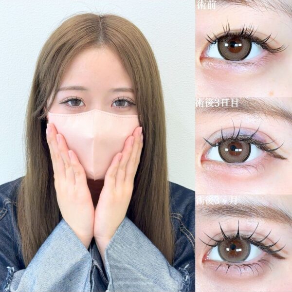 No.18690の症例写真 No.18690の症例写真