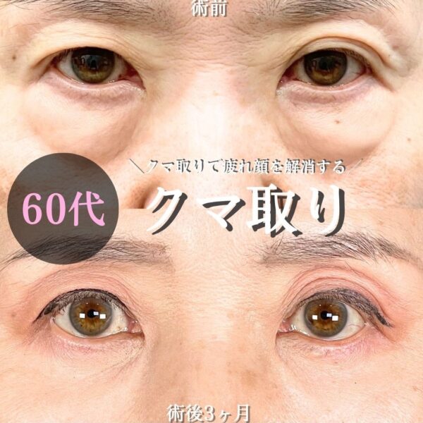 No.18782の症例写真