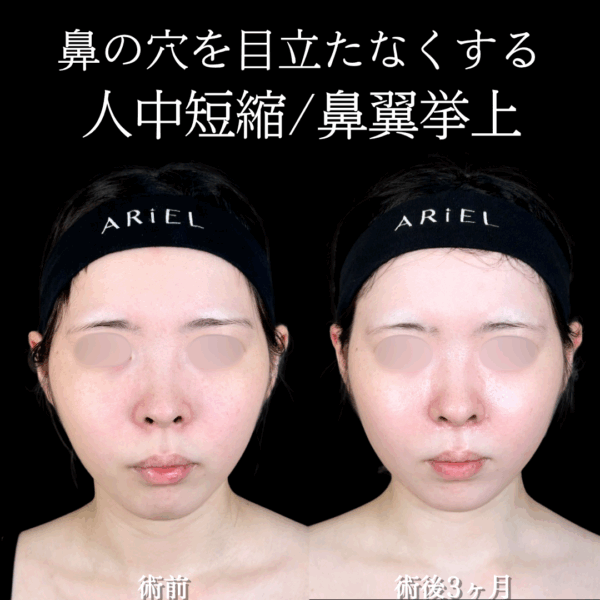 No.18769の症例写真 No.18769の症例写真