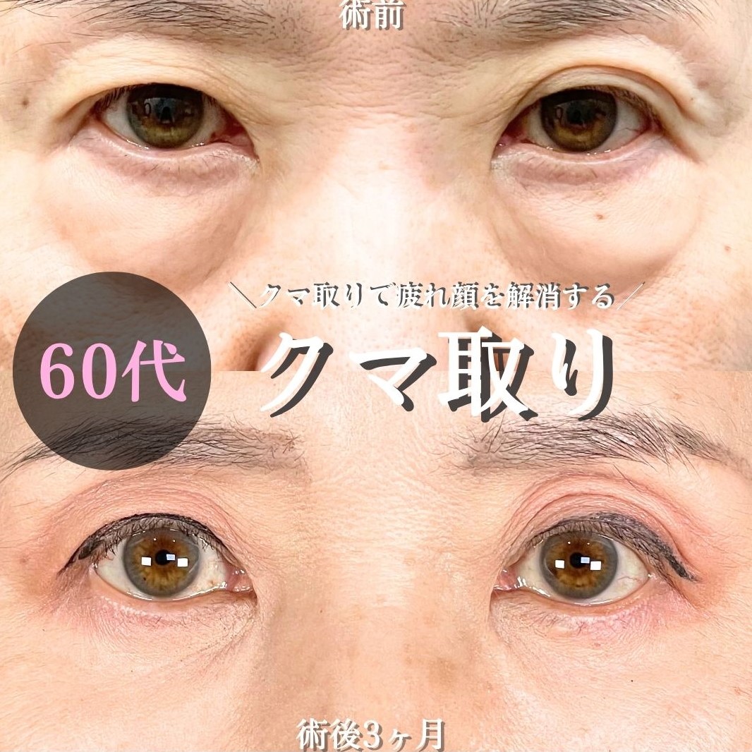 No.18782の症例写真