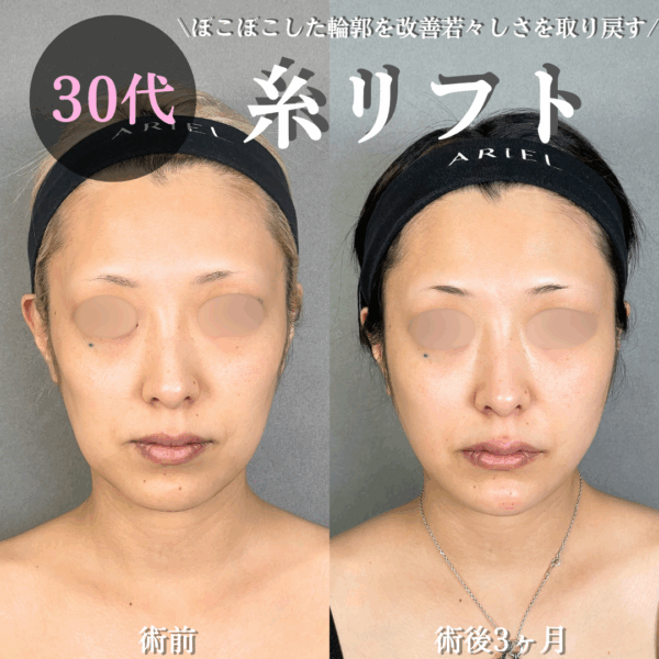 No.18925の症例写真