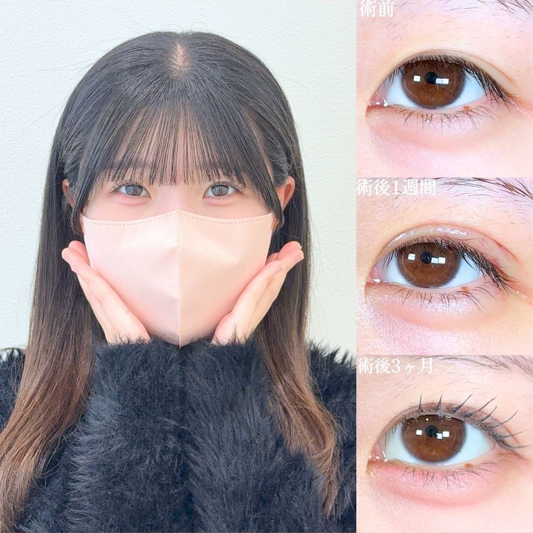 No.18828の症例写真