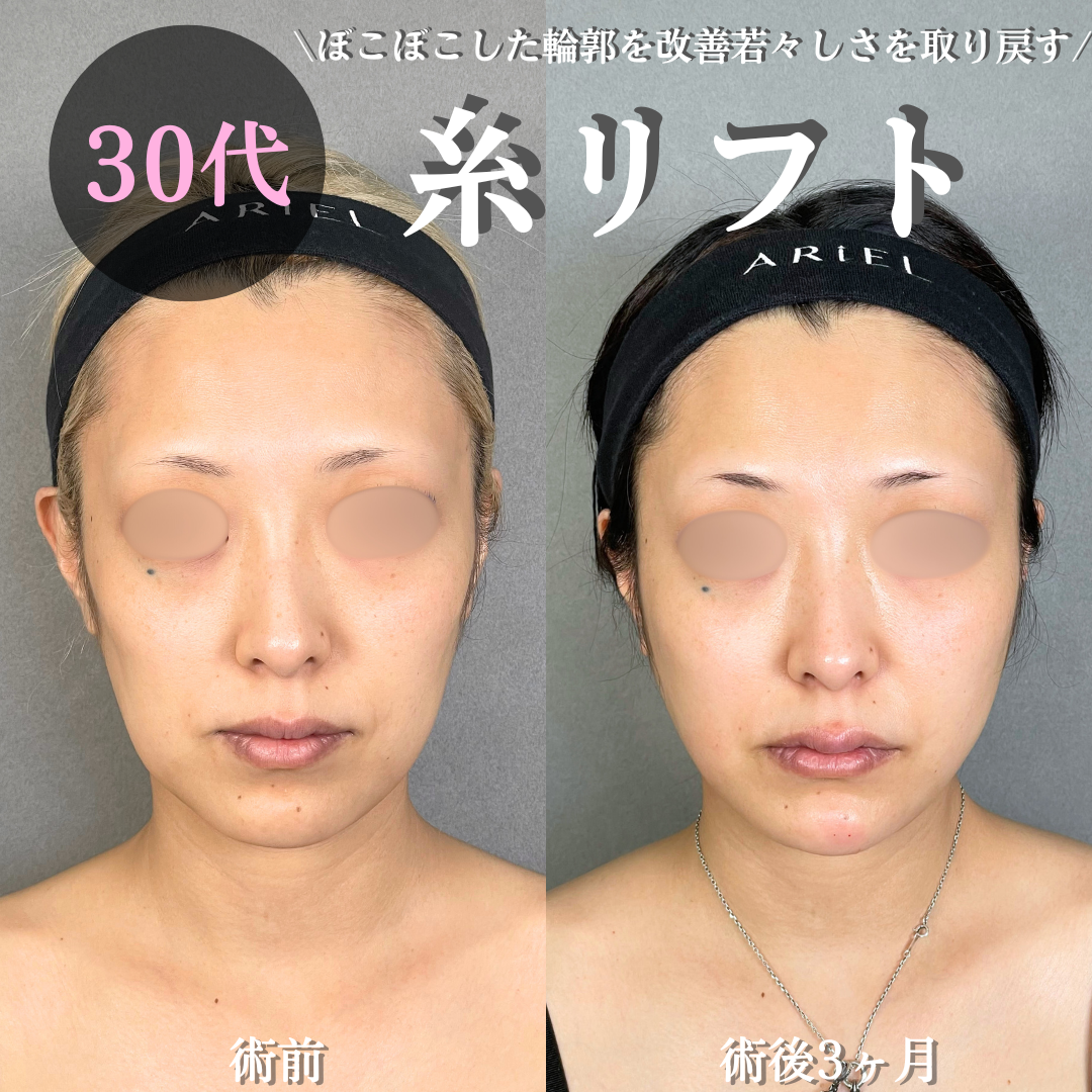 No.18925の症例写真