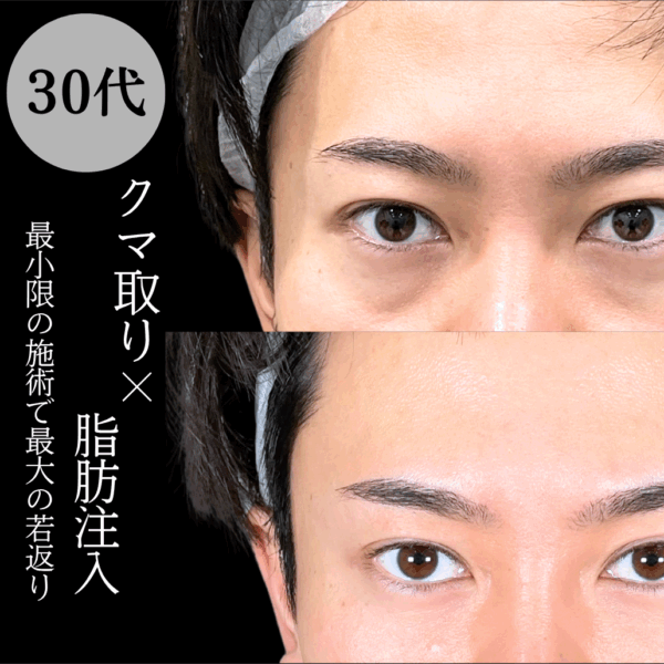 No.18487の症例写真