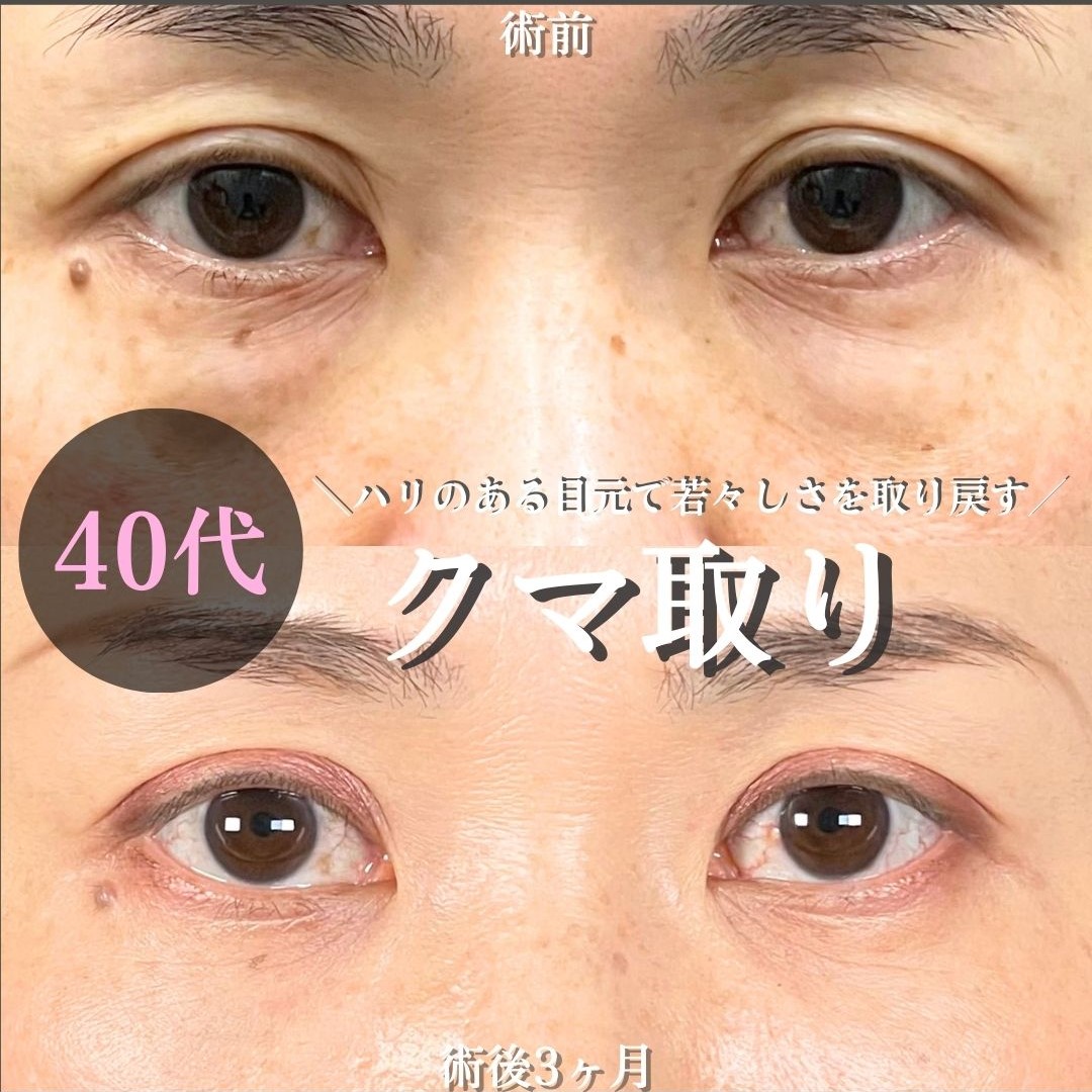 No.18827の症例写真