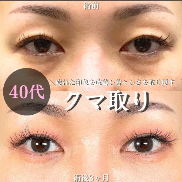 No.18951の症例写真