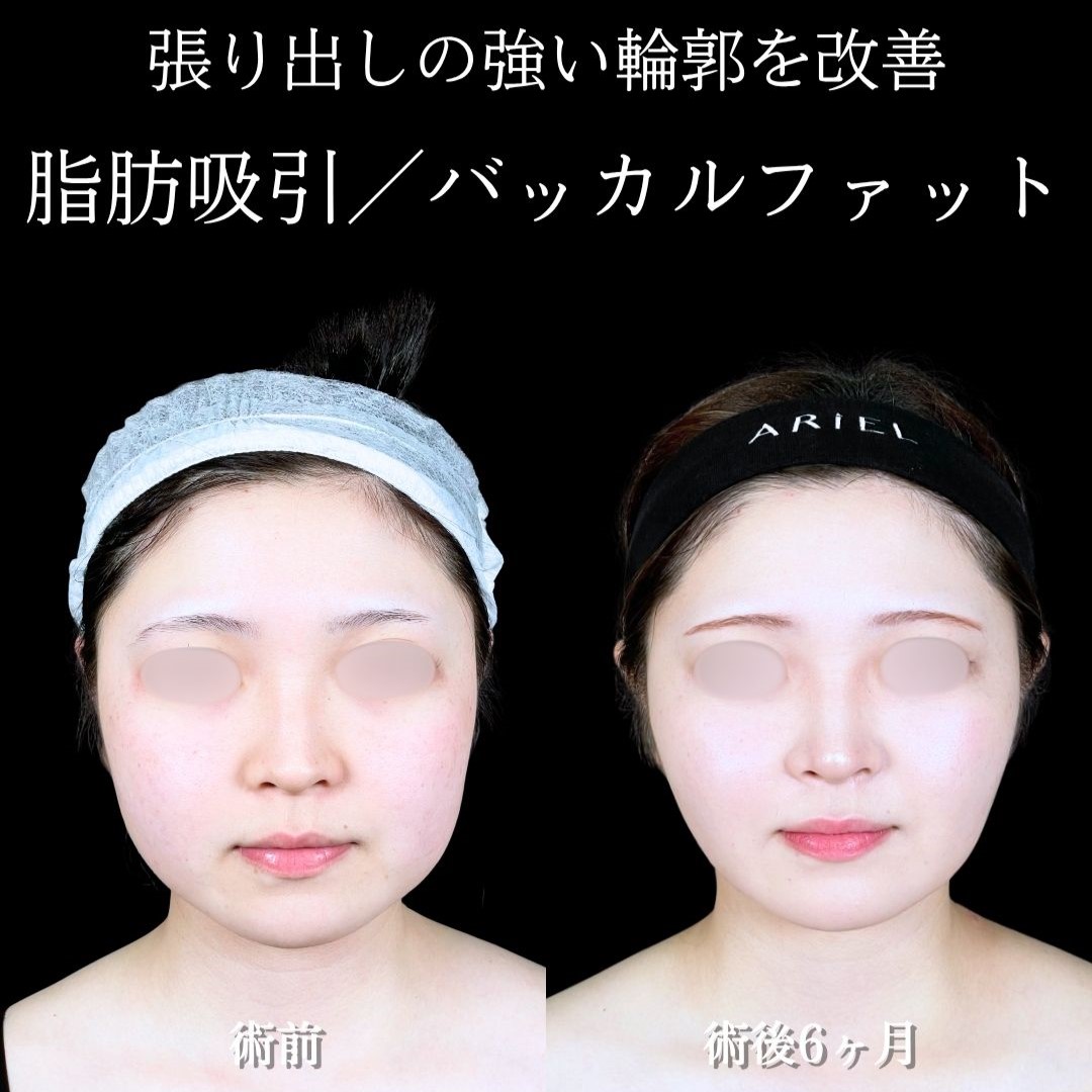 No.18494の症例写真